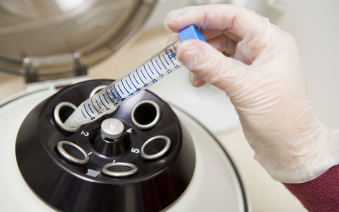 泰国第三代试管婴儿成功率有多少呢 一起来了解一下吧