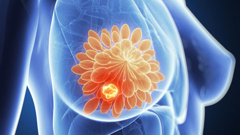 PNAS：老药新用，帮助抑制乳腺肿瘤生长_春雨国际