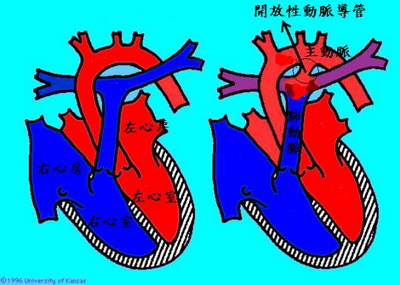 春雨国际 春雨国际医疗 黑色素瘤2.jpg