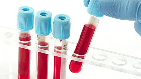 blood-test.jpg